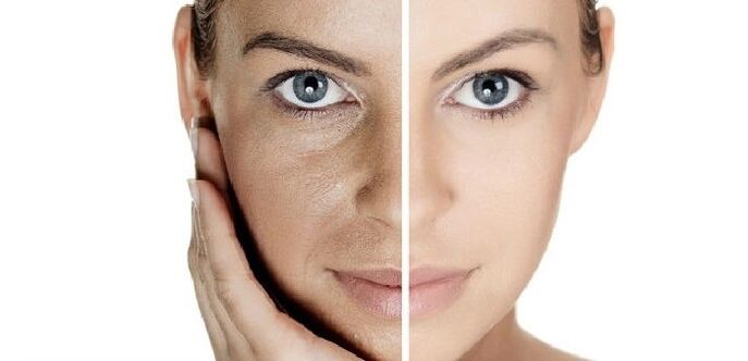 Avant et après le rajeunissement du visage