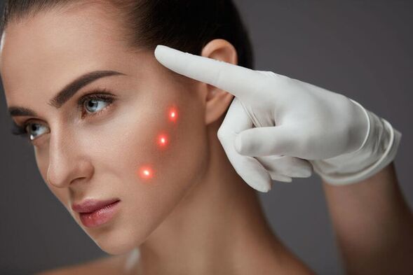 Réparation faciale au laser