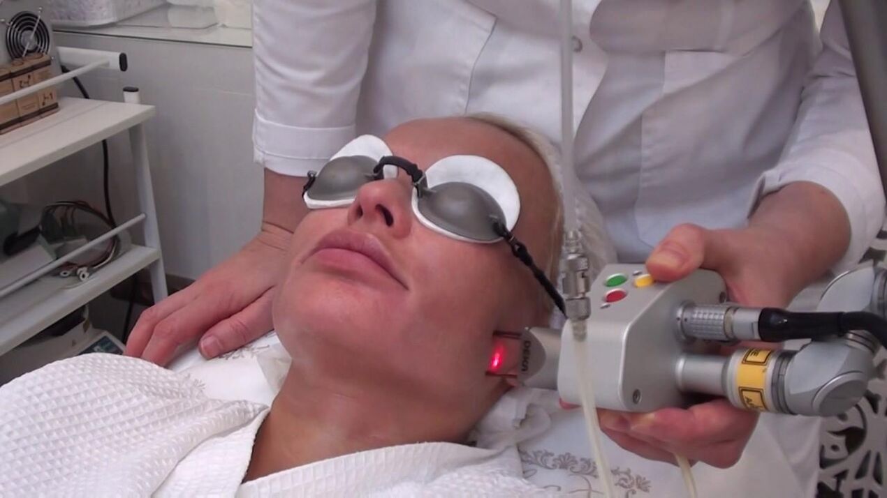 Traiter les zones à problèmes de la peau du visage avec un faisceau laser