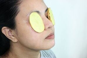 Utilisez des pommes de terre pour rajeunir le contour des yeux