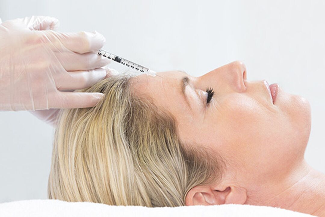 Le plasmolifting est une méthode d'injection pour le rajeunissement de la peau du visage